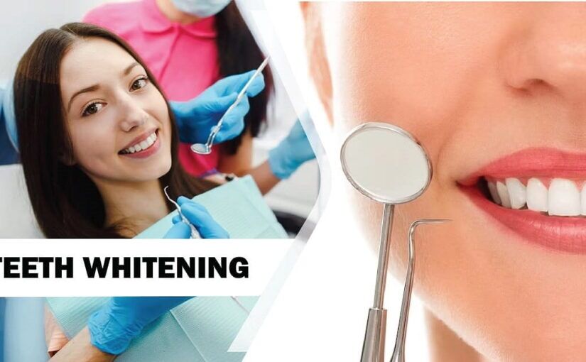 teeth whitening treatment
